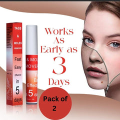 Tags & Moles Remover [BUY 1 GET 1 FREE]